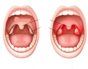 عمل لوزه چگونه است