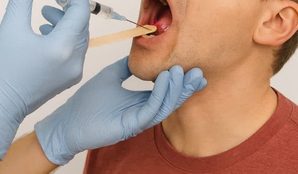 روشهای تخلیه عفونت گلو