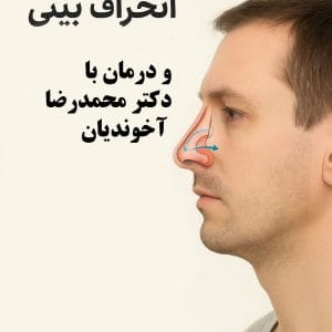 بهترین روش درمان انحراف بینی