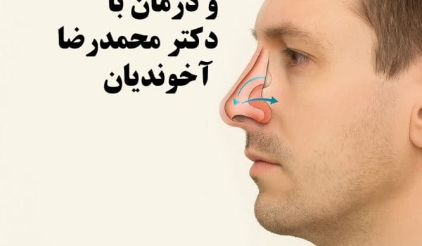 بهترین روش درمان انحراف بینی