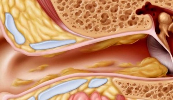 ترمیم پرده گوش در مشهد