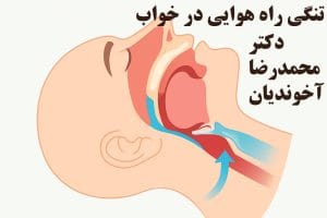 تنگی راه هوایی در خواب