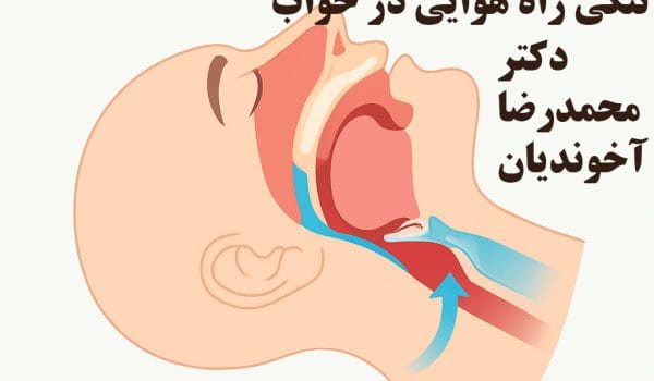 تنگی راه هوایی در خواب