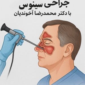 جراحی سینوس