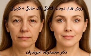 روش های درمان افتادگی پلک بدون جراحی