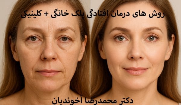 روش های درمان افتادگی پلک بدون جراحی