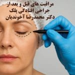 مراقبت های قبل و بعد از عمل افتادگی پلک