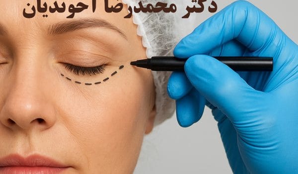 مراقبت های قبل و بعد از عمل افتادگی پلک