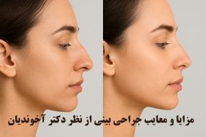 مزایا و معایب جراحی بینی
