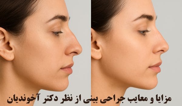 مزایا و معایب جراحی بینی