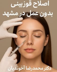 اصلاح قوز بینی بدون عمل در مشهد
