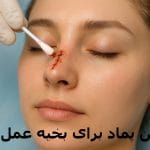 بهترین پماد برای بخیه عمل بینی