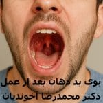 علت بوی بد دهان بعد از عمل لوزه