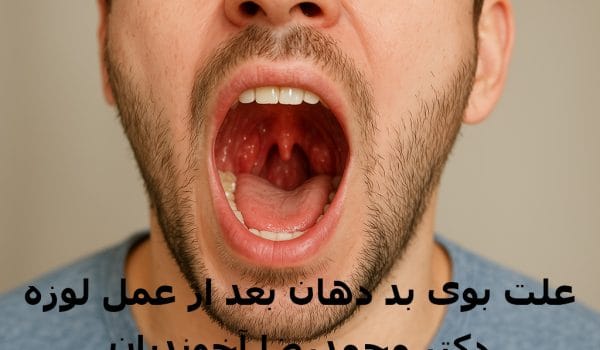 علت بوی بد دهان بعد از عمل لوزه
