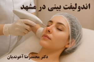 اندولیفت بینی در مشهد