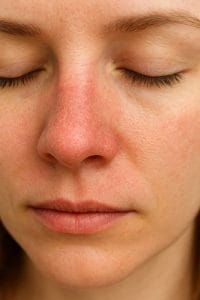 خشکی بینی؛ علت‌ها، علائم و روش‌های درمان مؤثر