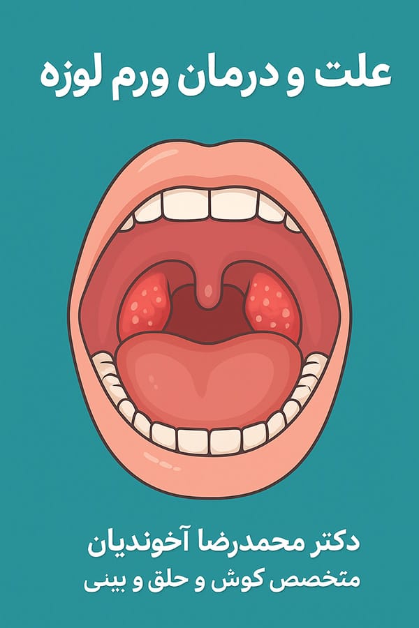 درمان ورم لوزه