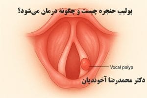 پولیپ حنجره چیست و چگونه درمان می‌شود؟