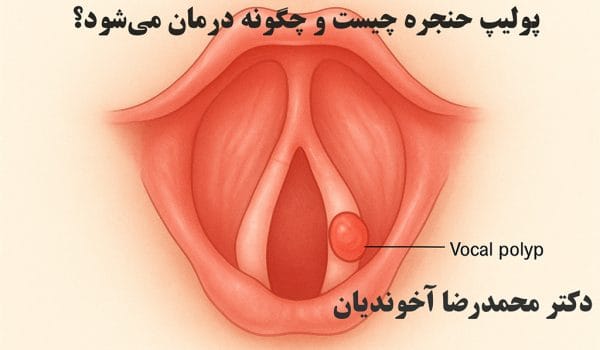 پولیپ حنجره چیست و چگونه درمان می‌شود؟