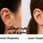تفاوت اتوپلاستی سنتی و لیزری