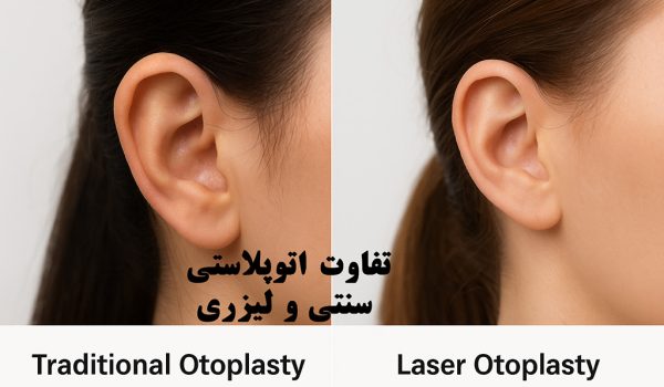 تفاوت اتوپلاستی سنتی و لیزری