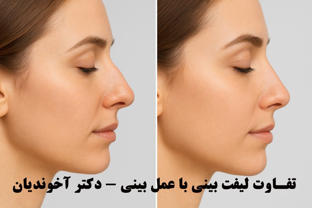 تفاوت لیفت بینی با عمل بینی - دکتر آخوندیان