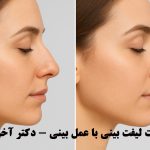 تفاوت لیفت بینی با عمل بینی - دکتر آخوندیان