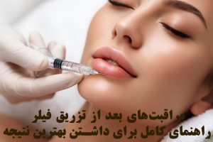 مراقبت‌های بعد از تزریق فیلر؛ راهنمای کامل برای داشتن بهترین نتیجه