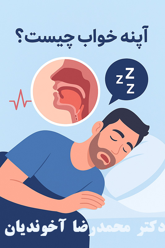 آپنه خواب چیست