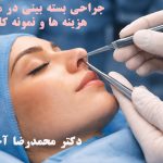 جراحی بسته بینی در مشهد- هزینه ها و نمونه کارها