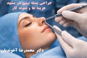 جراحی بسته بینی در مشهد- هزینه ها و نمونه کارها