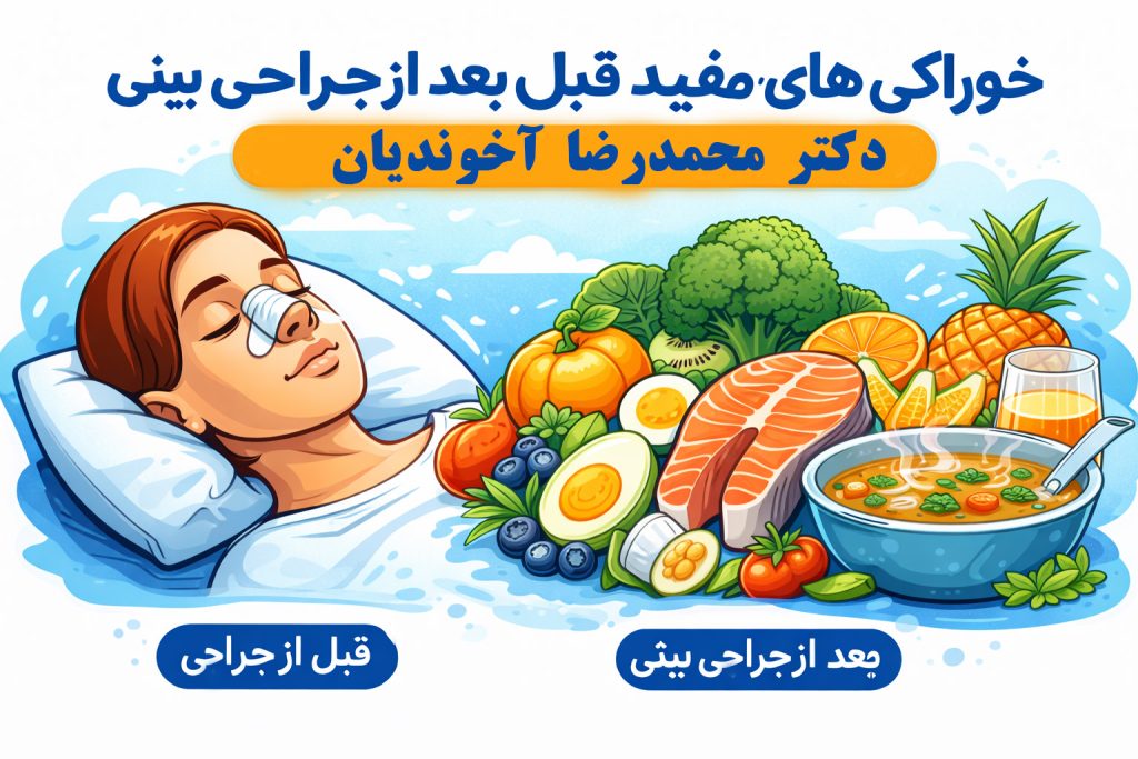 خوراکی‌های مفید قبل و بعد از جراحی بینی