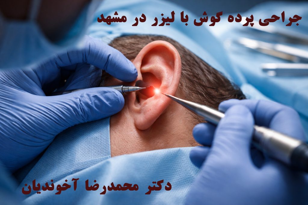 جراحی پرده گوش با لیزر در مشهد