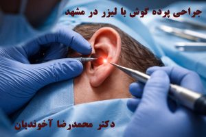 جراحی پرده گوش با لیزر در مشهد