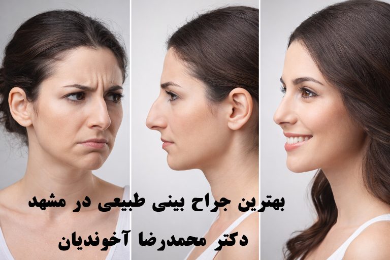 بهترین جراح بینی طبیعی در مشهد