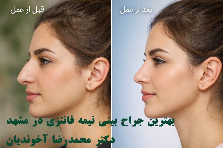 بهترین جراح بینی نیمه فانتزی در مشهد