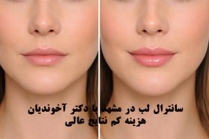 سانترال لب در مشهد
