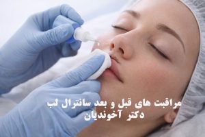 مراقبت های قبل و بعد سانترال لب