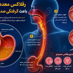 رفلاکس معده چگونه باعث گرفتگی صدا می‌شود؟