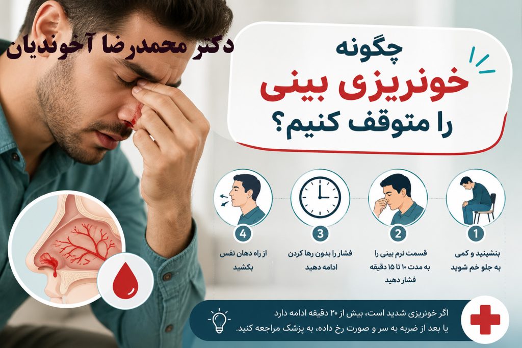 چگونه خونریزی بینی را متوقف کنیم